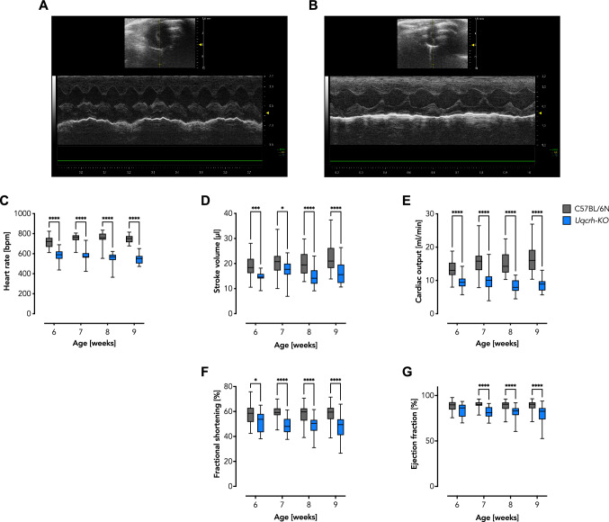 Knockout of the Complex III subunit Uqcrh causes bioenergetic impairment and cardiac contractile dysfunction.