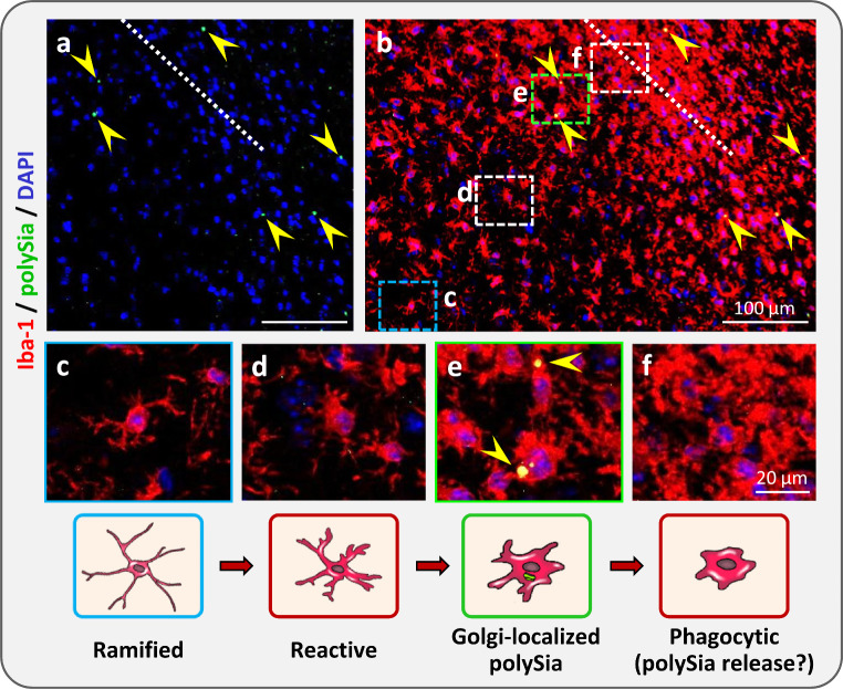 Neuroimmunomodulatory properties of polysialic acid.