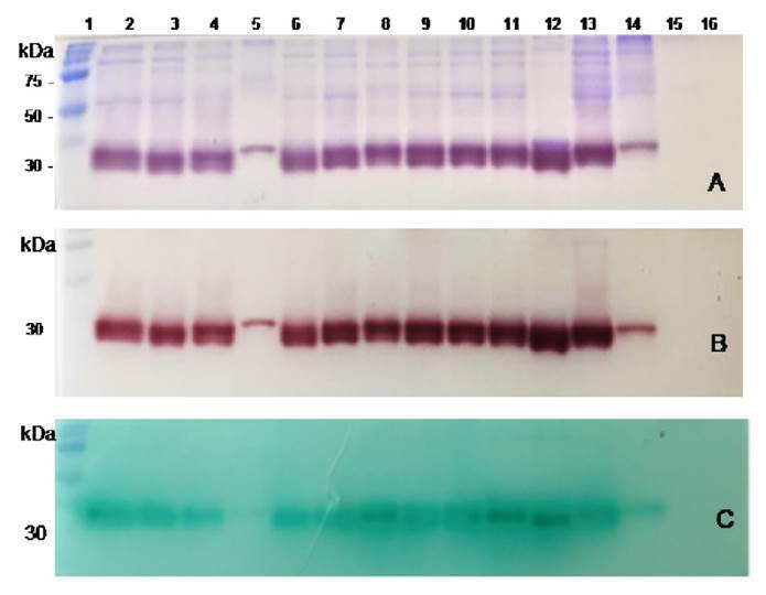 Detection and expression of SapS, a class C nonspecific acid phosphatase with O-phospho-Ltyrosine- phosphatase activity, in Staphylococcus aureus isolates from patients with chronic osteomyelitis