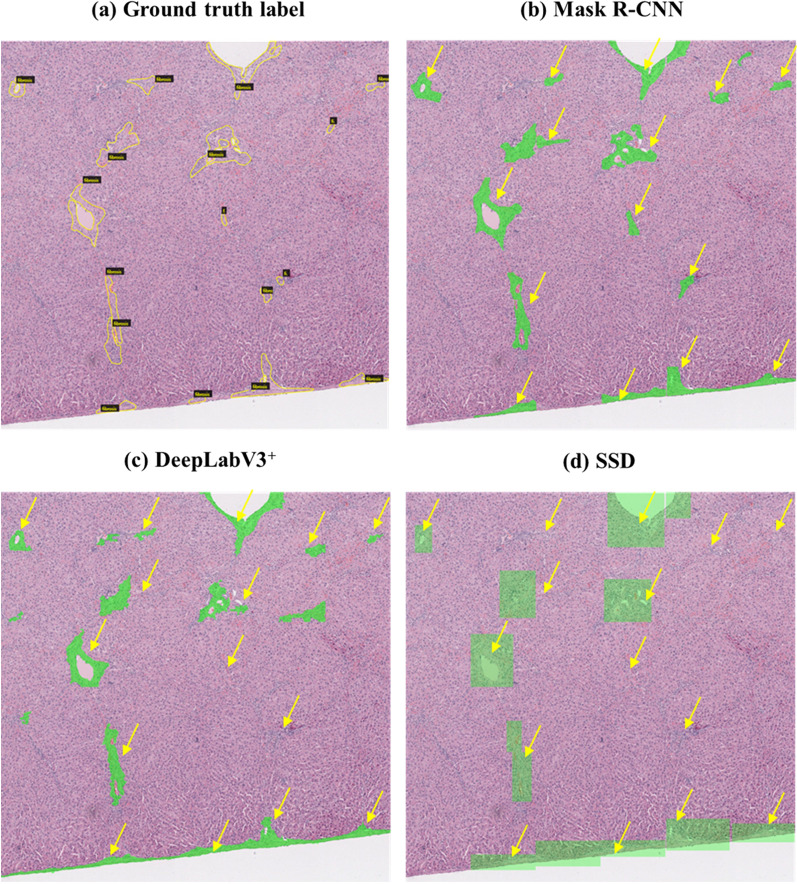 Segmentation algorithm can be used for detecting hepatic fibrosis in SD rat.