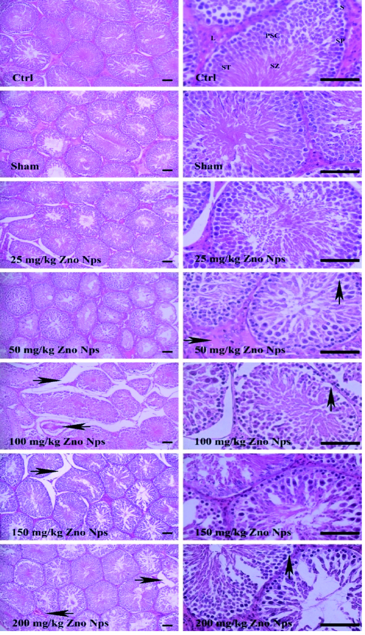 Study of different doses of zinc oxide nanoparticles by intraperitoneal and gavage methods on testicular tissue in Wistar rats: An experimental study.