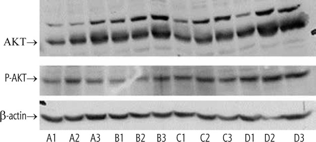 Increased hepatic Akt phosphorylation alleviated glucose intolerance and improved liver function in leptin-deficient mice.