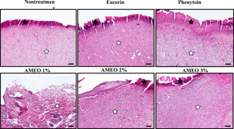 <i>In vitro</i> Antibacterial Activity and Wound Healing Effects of <i>Achillea millefolium</i> Essential Oil in Rat.