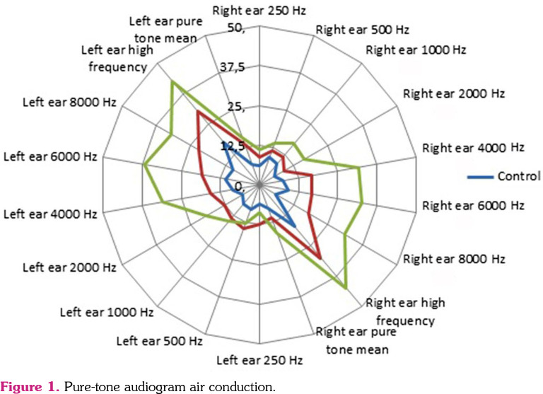 Hearing loss can also be seen in patients with nonradiographic axial spondyloarthropathies as well as radiographic axial spondyloarthropathies.