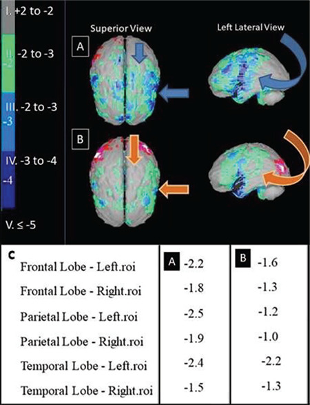 Brain Perfusion Changes in a Patient with Facial Trauma.