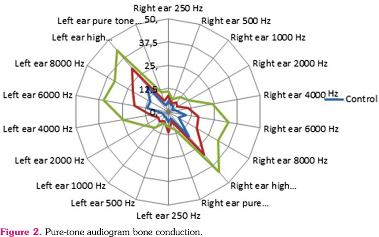 Hearing loss can also be seen in patients with nonradiographic axial spondyloarthropathies as well as radiographic axial spondyloarthropathies.