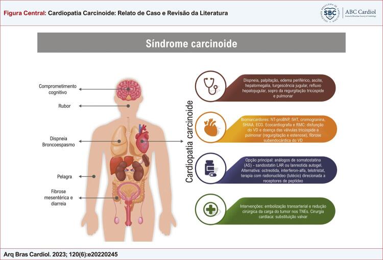 Carcinoid Heart Disease: A Case Report and Literature Review.