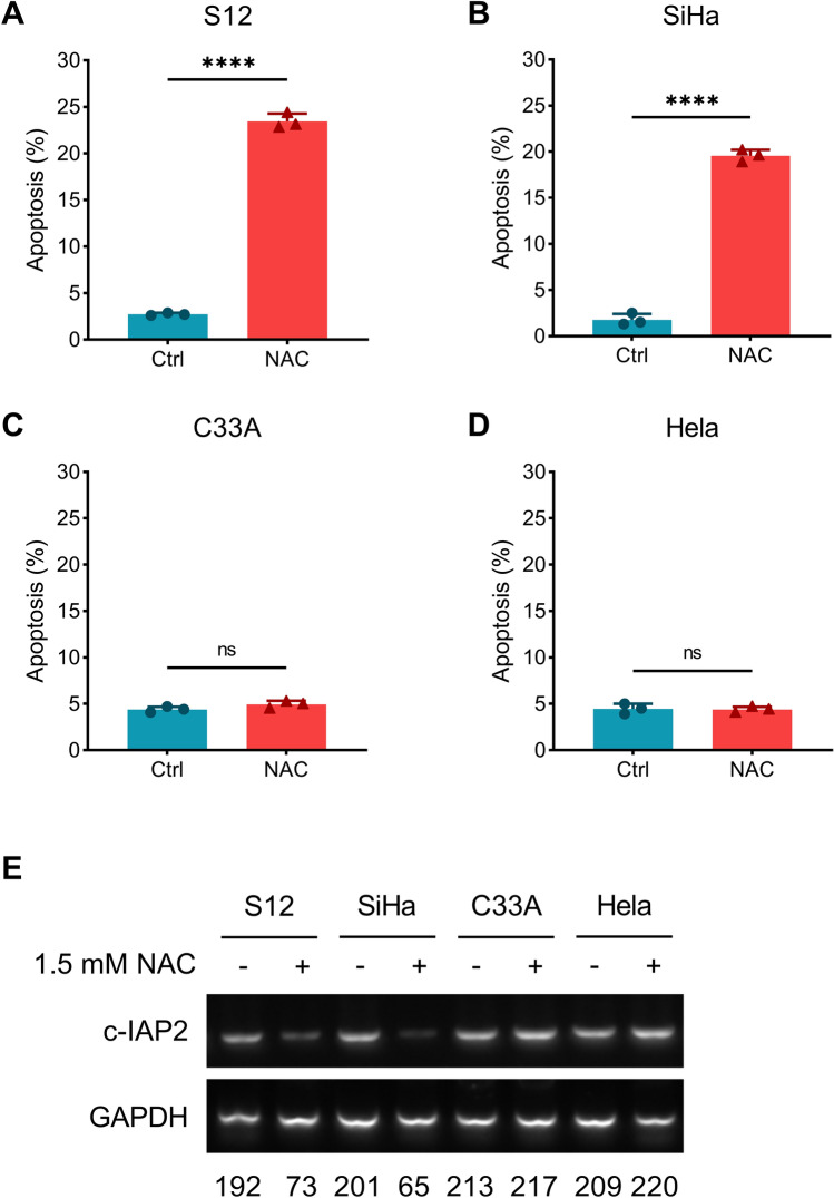 N-Acetyl-L-Cysteine Reduces Cervical Carcinogenesis by Promoting Apoptosis.