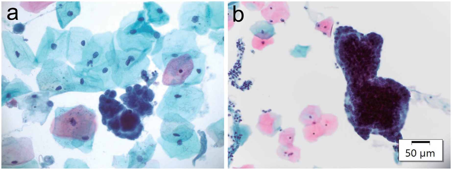 Updates in Cervical Cancer Screening Guidelines, The Bethesda System for Reporting Cervical Cytology, and Clinical Management Recommendations.