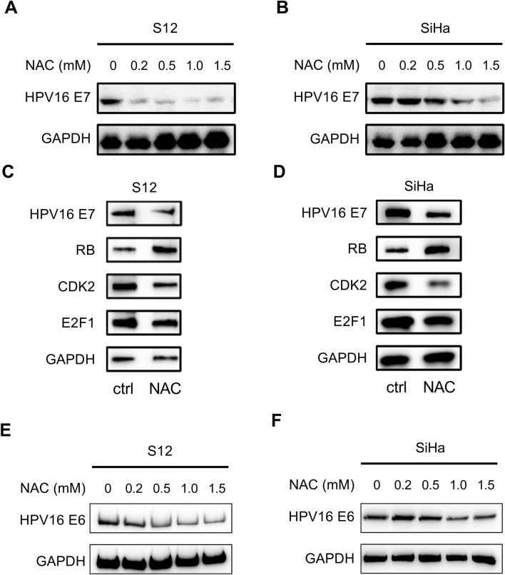 N-Acetyl-L-Cysteine Reduces Cervical Carcinogenesis by Promoting Apoptosis.