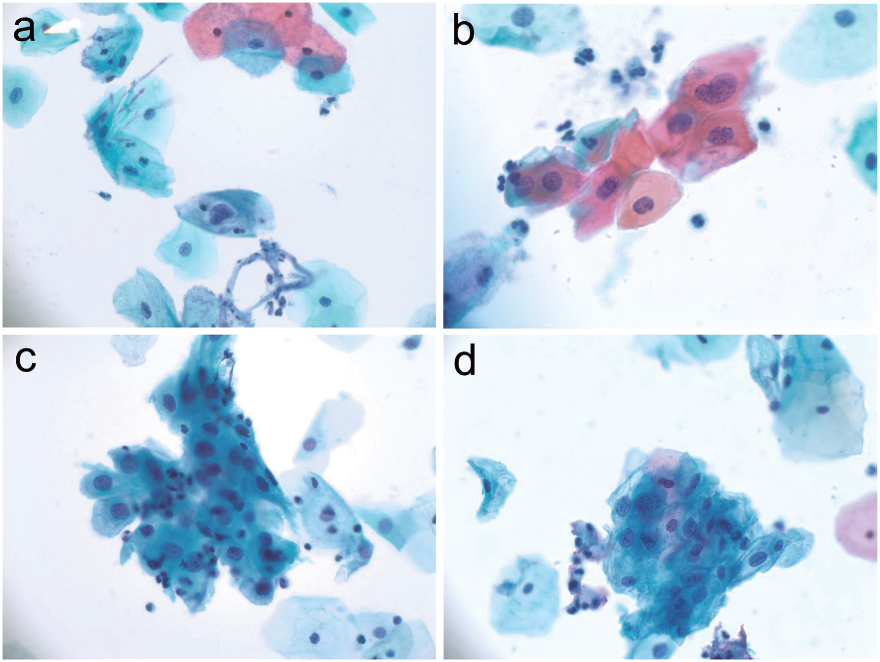 Updates in Cervical Cancer Screening Guidelines, The Bethesda System for Reporting Cervical Cytology, and Clinical Management Recommendations.