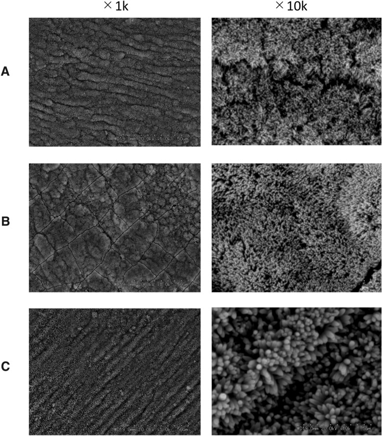 Regaining enamel color quality using enamel matrix derivative.