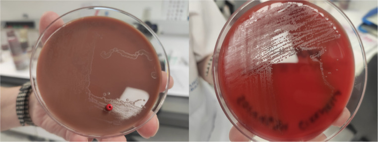 Bacteremia caused by Eikenella corrodens in a patient with pelvic inflammatory disease.