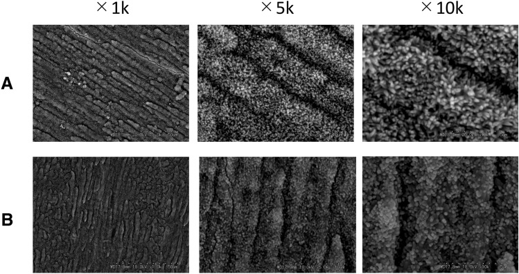 Regaining enamel color quality using enamel matrix derivative.