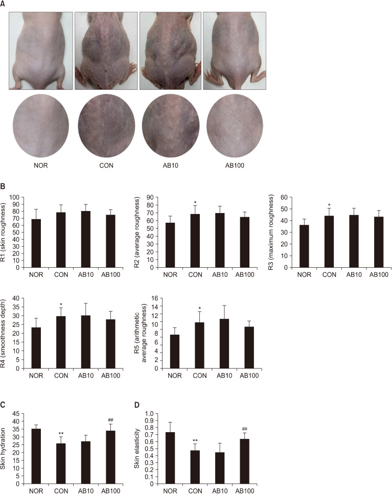 AGEs Blocker™ (Goji Berry, Fig, and Korean Mint Mixed Extract) Inhibits Skin Aging Caused by Streptozotocin-Induced Glycation in Hairless Mice.