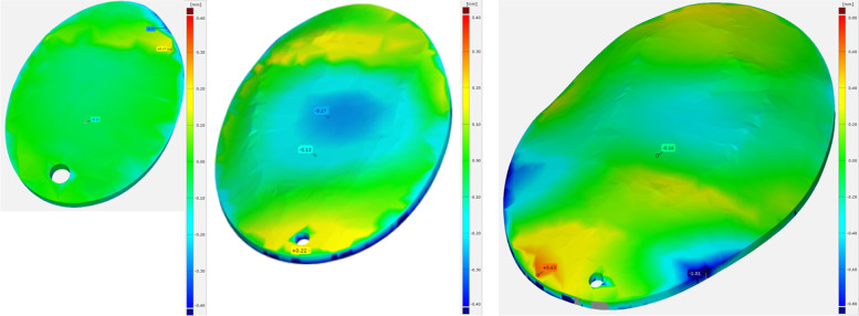 Development of 3D printed patient-specific skull implants based on 3d surface scans.