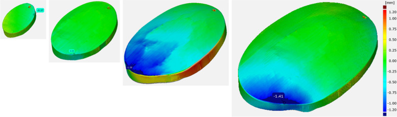 Development of 3D printed patient-specific skull implants based on 3d surface scans.