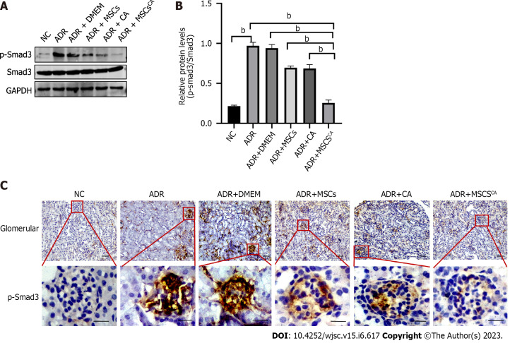 Synergism of calycosin and bone marrow-derived mesenchymal stem cells to combat podocyte apoptosis to alleviate adriamycin-induced focal segmental glomerulosclerosis.