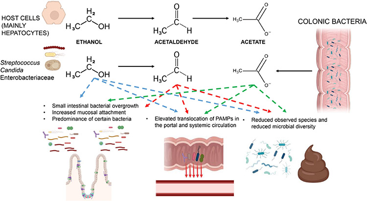 Alcohol-associated bowel disease: new insights into pathogenesis.