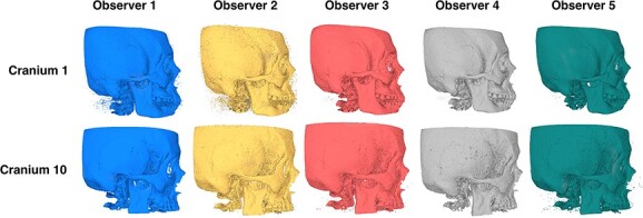 Sex estimation from virtual models: exploring the potential of stereolithic 3D crania models for morphoscopic trait scoring.