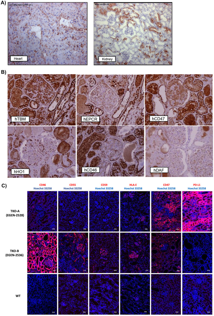 Kidney Xenotransplantation: Are We Ready for Prime Time?