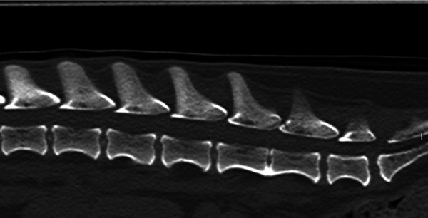 Interobserver agreement of computed tomography in detecting calcified intervertebral discs in comparison with radiography in a population of 13 healthy British Dachshund dogs.