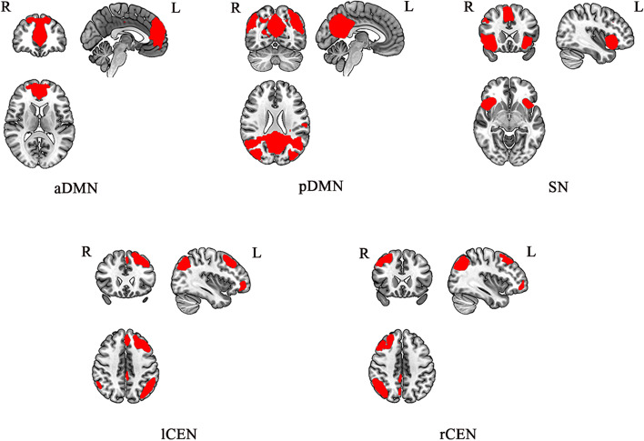 Altered intrinsic functional network connectivity is associated with impulsivity and emotion dysregulation in drug-naïve young patients with borderline personality disorder.