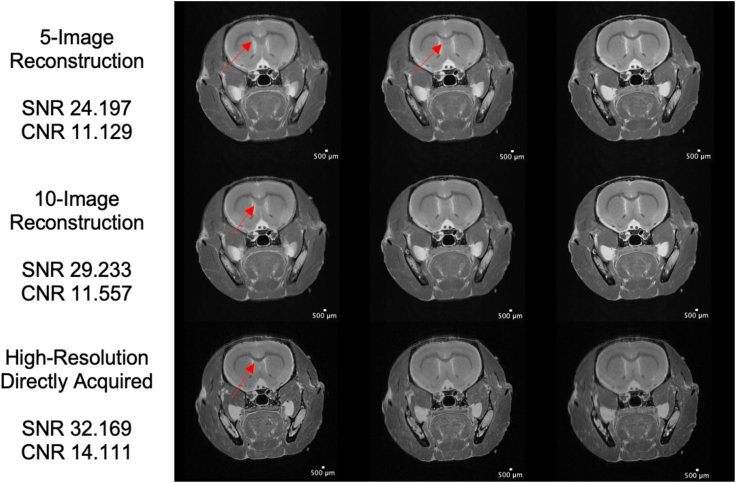 Super-resolution reconstruction in ultrahigh-field MRI.