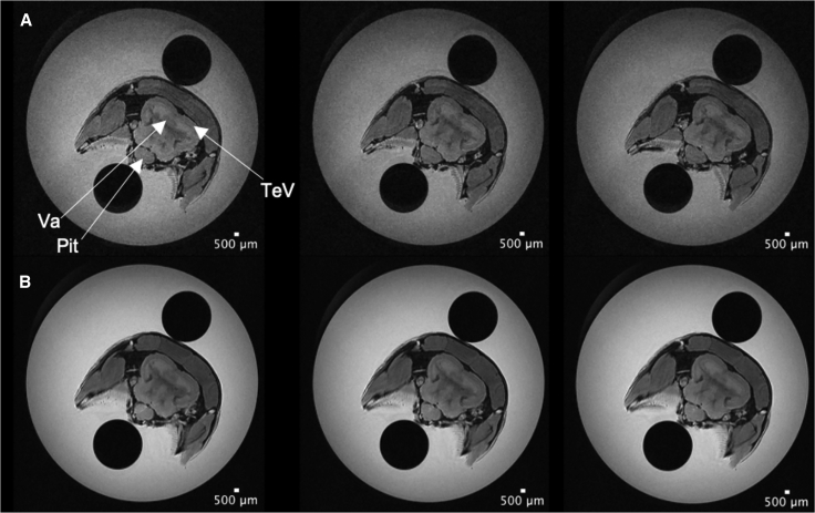 Super-resolution reconstruction in ultrahigh-field MRI.