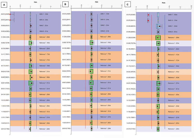 The Frequency of <i>SMN1, SMN2</i> Copy Numbers in 246 Turkish Cases Analyzed with MLPA Method.