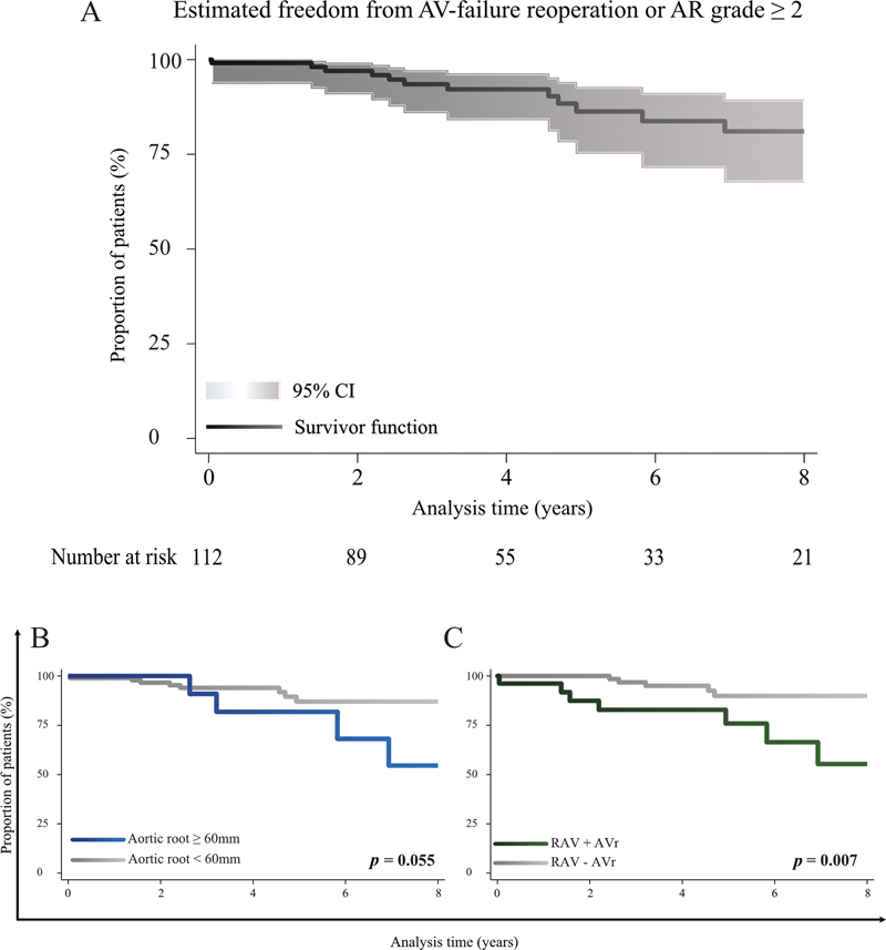 Reoperation or Aortic Regurgitation Progression after Reimplantation of the Aortic Valve (David's Procedure) Using the Valsalva Graft.