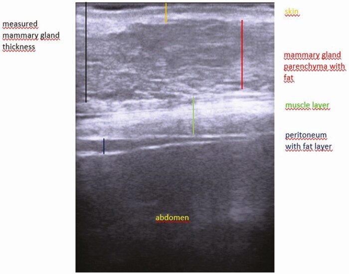 Lactation in swine: review article.