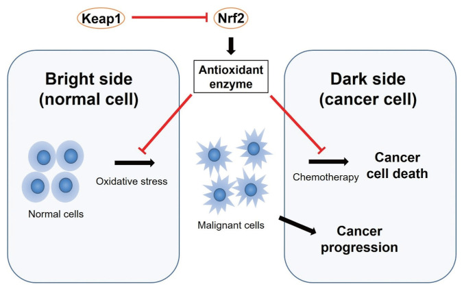 Impact of Nrf2 overexpression on cholangiocarcinoma treatment and clinical prognosis.