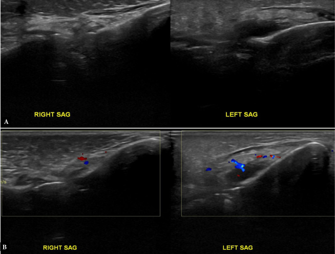 Maxillofacial inflammations visualized with ultrasonography. Description of the imaging features and literature review based on a characteristic case series.