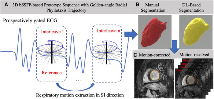 Deep learning-based left ventricular segmentation demonstrates improved performance on respiratory motion-resolved whole-heart reconstructions.