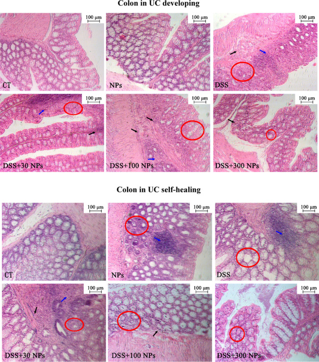 Oral intake of titanium dioxide nanoparticles affect the course and prognosis of ulcerative colitis in mice: involvement of the ROS-TXNIP-NLRP3 inflammasome pathway.