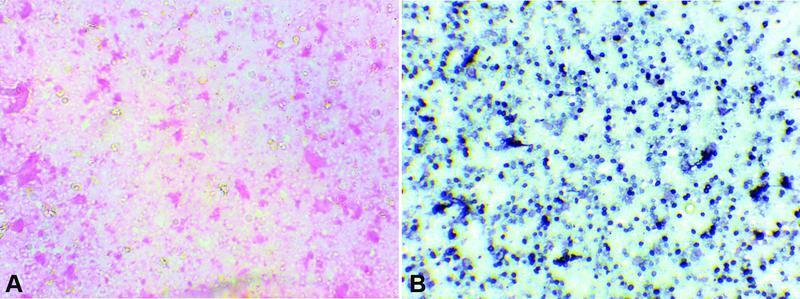 Histoplasmosis of Adrenal Gland: A 5 Years' Review from a Multispecialty Diagnostic Centre.