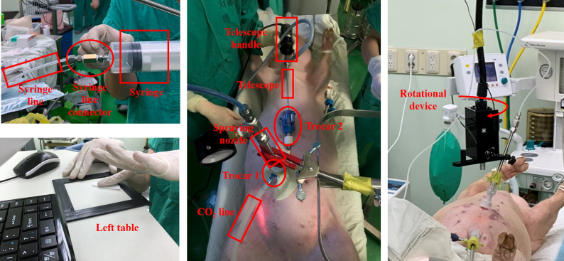 Occupational Exposure during Intraperitoneal Pressurized Aerosol Chemotherapy Using Doxorubicin in a Pig Model