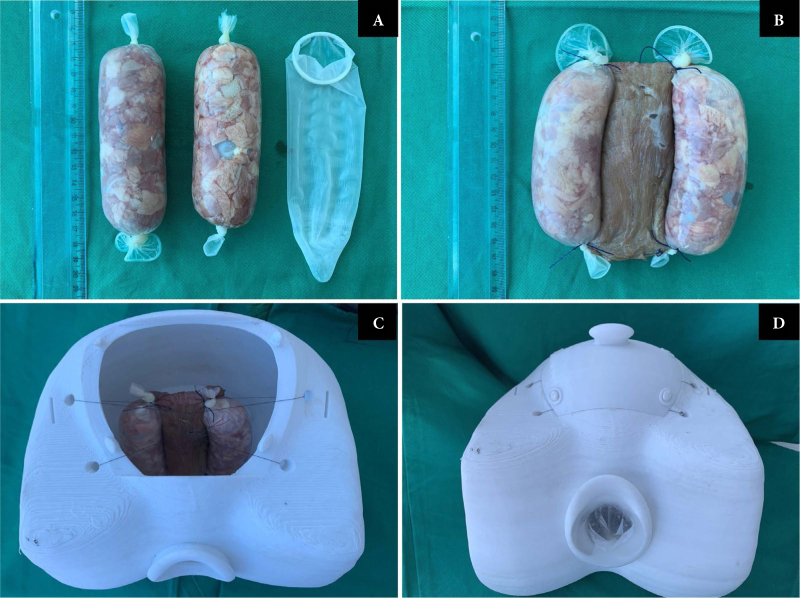 Self-made transvaginal ultrasound simulator: new training equipment in ultrasound evaluation of controlled ovarian stimulation and oocyte retrieval.