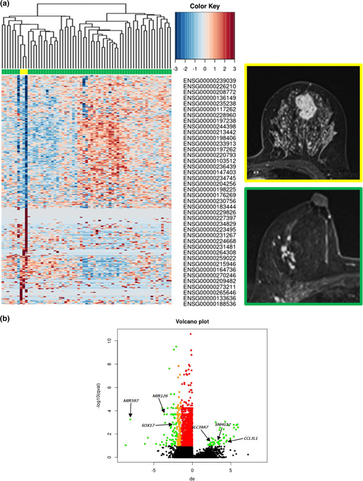 MRI-based breast cancer radiogenomics using RNA profiling: association with subtypes in a single-center prospective study.