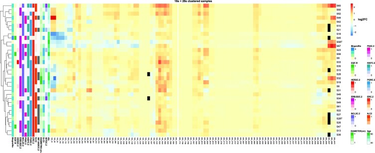 Alterations of ribosomal RNA pseudouridylation in human breast cancer.