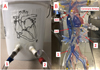 3D-Printed silicone anatomic patient simulator to enhance training on cardiopulmonary bypass.