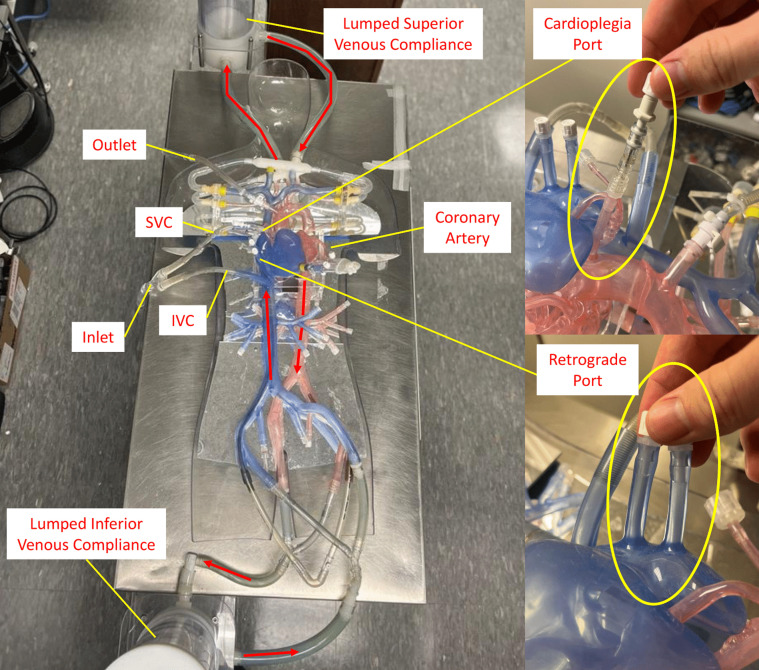 3D-Printed silicone anatomic patient simulator to enhance training on cardiopulmonary bypass.