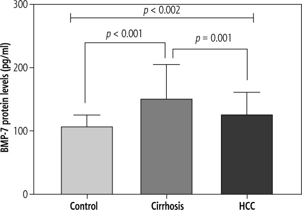 Bone morphogenic protein-7 (BMP-7) polymorphism: Susceptibility to cirrhosis and hepatocellular carcinoma after viral hepatitis in Egyptian patients.