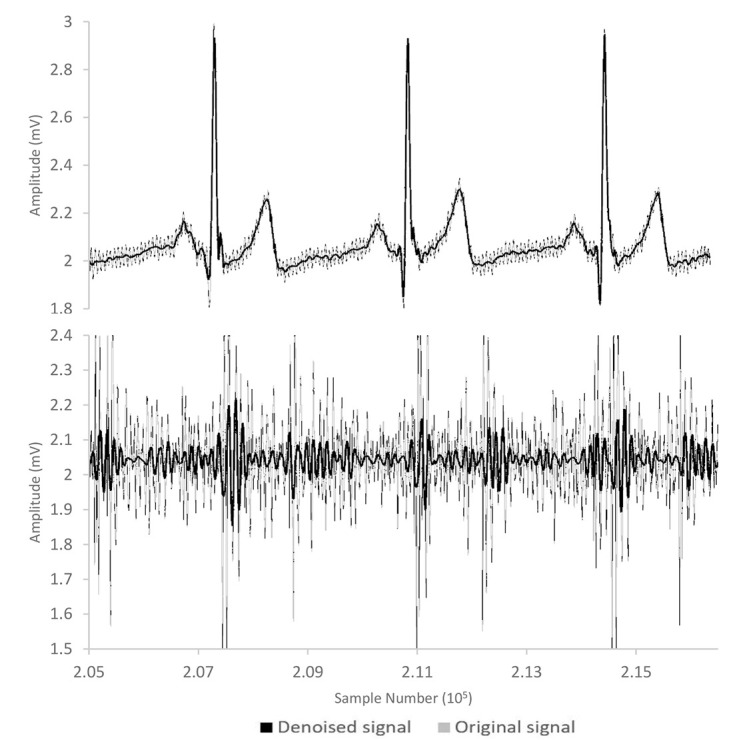 A Hardware-Software System for Accurate Segmentation of Phonocardiogram Signal.