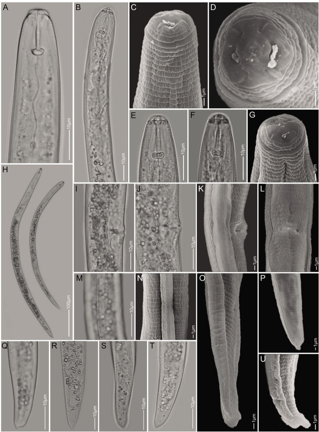 First Reports and Morphological and Molecular Characterization of <i>Pratylenchus delattrei</i> and <i>Quinisulcius capitatus</i> Associated with Chickpea in Ethiopia.