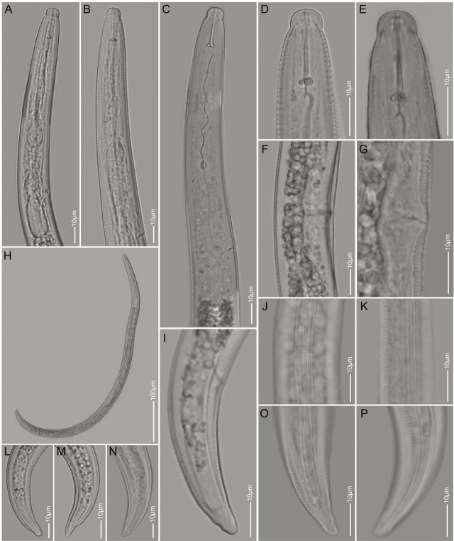 First Reports and Morphological and Molecular Characterization of <i>Pratylenchus delattrei</i> and <i>Quinisulcius capitatus</i> Associated with Chickpea in Ethiopia.