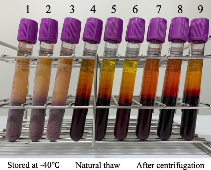 Investigation of optimal procedures for storage and use of plasma samples suitable for gene doping tests.