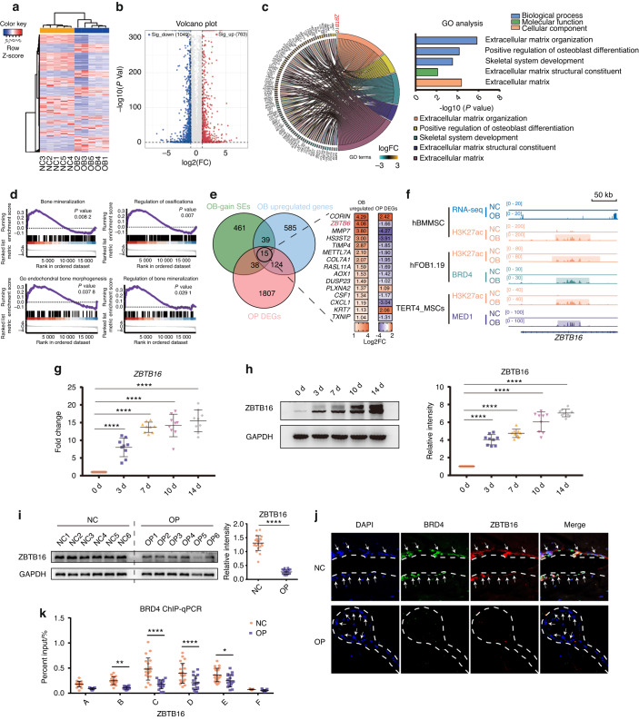 Author Correction: Super enhancers targeting ZBTB16 in osteogenesis protect against osteoporosis.