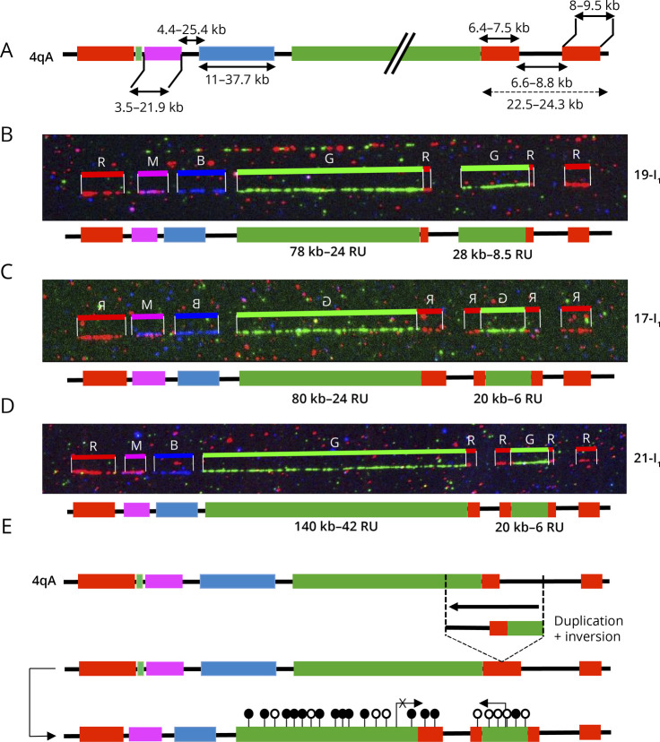 Complex 4q35 and 10q26 Rearrangements: A Challenge for Molecular Diagnosis of Patients With Facioscapulohumeral Dystrophy.